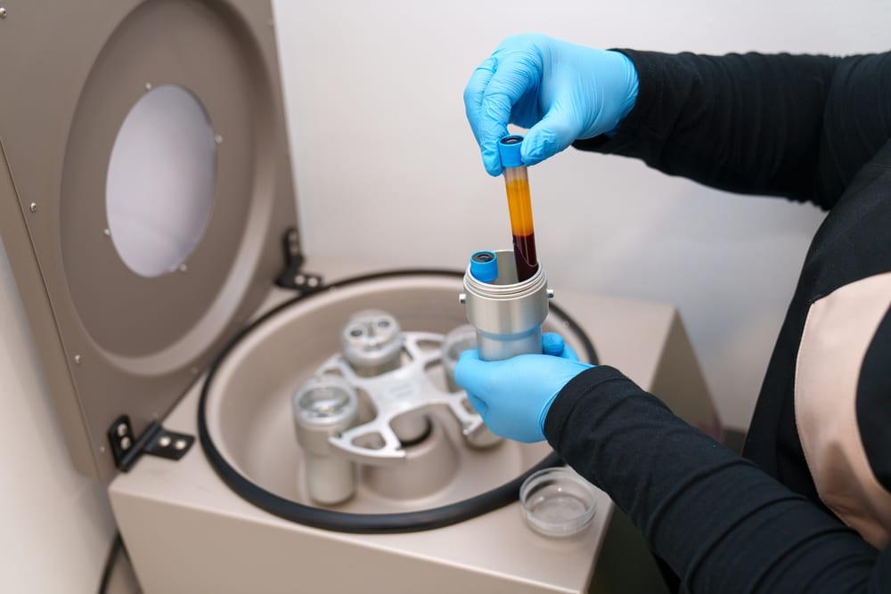 Centrifugation pour préparation du PRP