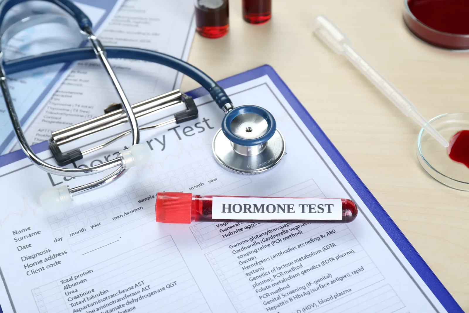 Testosterone deficiency